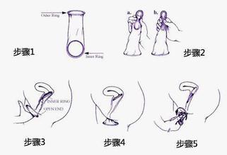避孕套的用途/有哪些作用 保险套的作用