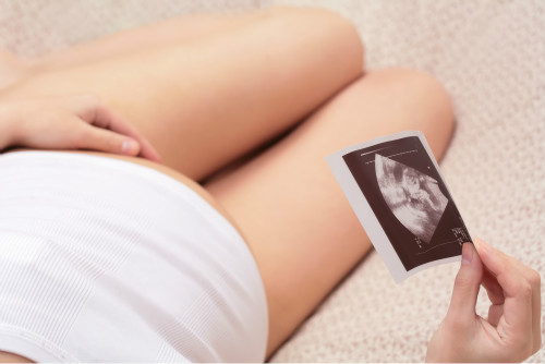 最科学适合孕妈咪的食谱是啥？