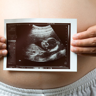 怀孕第8周孕产检小贴士 了解B超检查