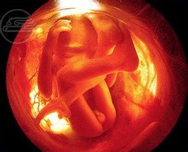 三十三周胎儿图片欣赏图片